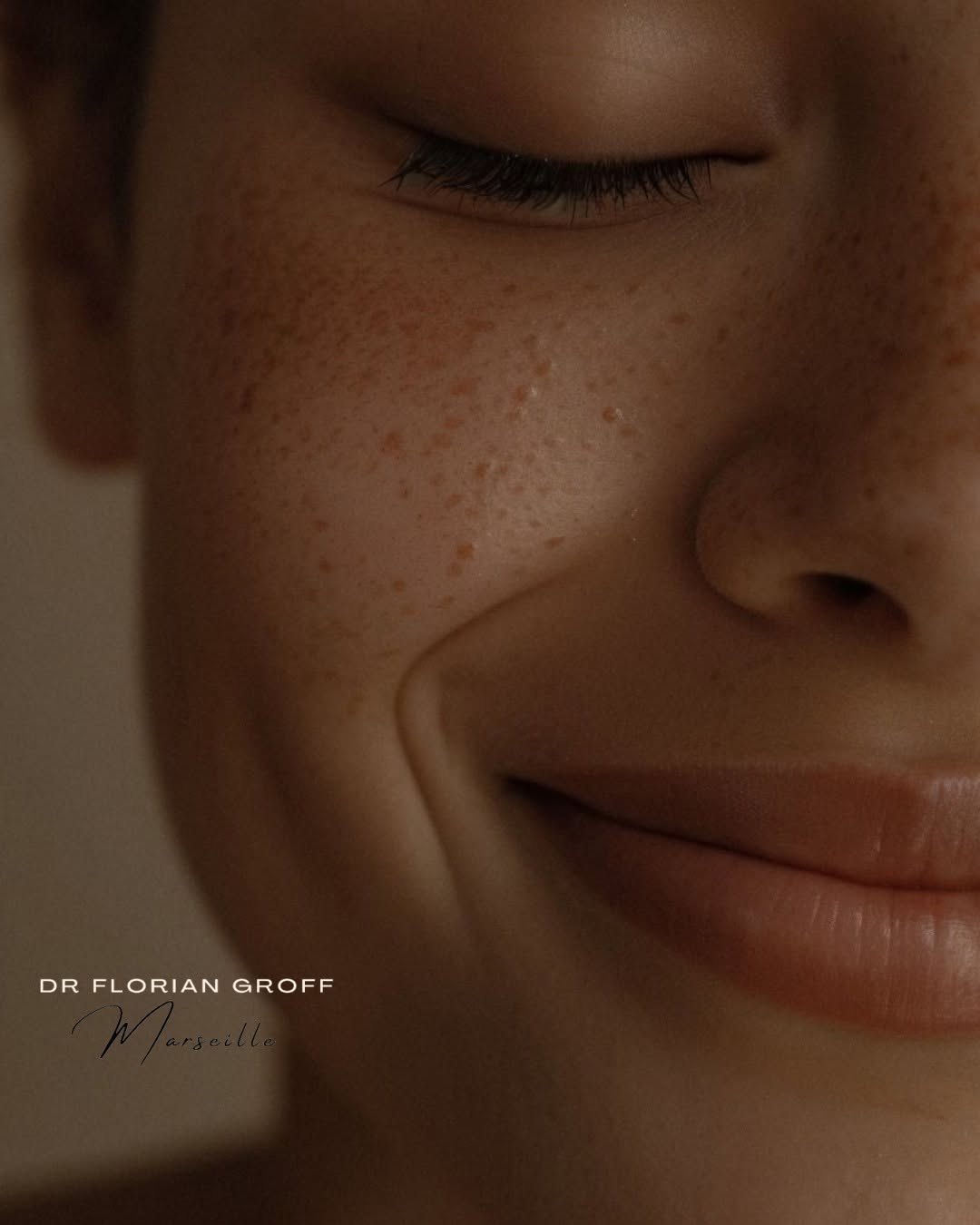 Médecine esthétique peau, Dr Florian Groff Marseille